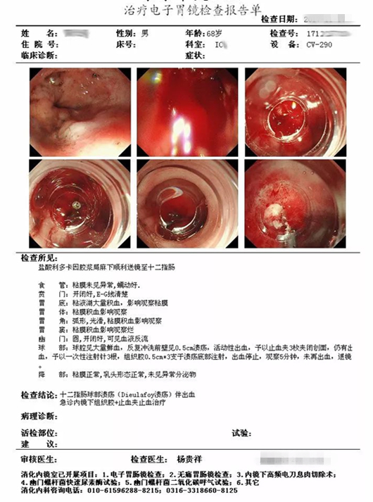 十二指肠球部溃疡出血图片