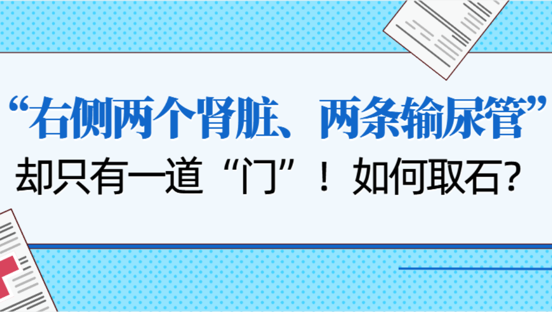 【临床案例】“重复肾”却只有一道门，如何碎石取石？